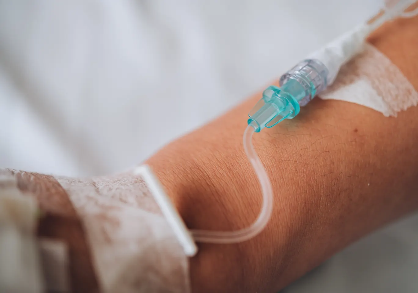 Kroplówki witaminowe Płońsk: wenflon oklejony na przedramieniu podczas wlewu